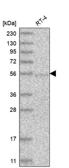 Western blot analysis in human cell line RT-4.