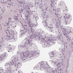 Immunohistochemical staining of human prostate shows no positivity in glandular cells as expected.