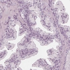 Immunohistochemical staining of human prostate shows no positivity in glandular cells as expected.