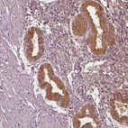 Immunohistochemical staining of human endometrium shows moderate cytoplasmic positivity in glandular cells.