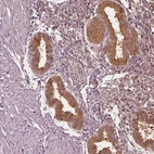 Immunohistochemical staining of human endometrium shows moderate cytoplasmic positivity in glandular cells.