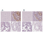 Immunohistochemical staining of human cerebral cortex, endometrium, prostate and testis using Anti-PAEP antibody HPA029473 (A) shows similar protein distribution across tissues to independent antibody HPA020108 (B).