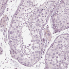 Immunohistochemical staining of human testis shows no positivity in cells in seminiferous ducts as expected.