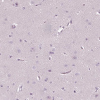 Immunohistochemical staining of human cerebral cortex shows no positivity in neurons as expected.