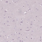 Immunohistochemical staining of human cerebral cortex shows no positivity in neurons as expected.