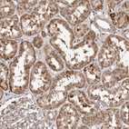 Anti-MACC1 Antibody