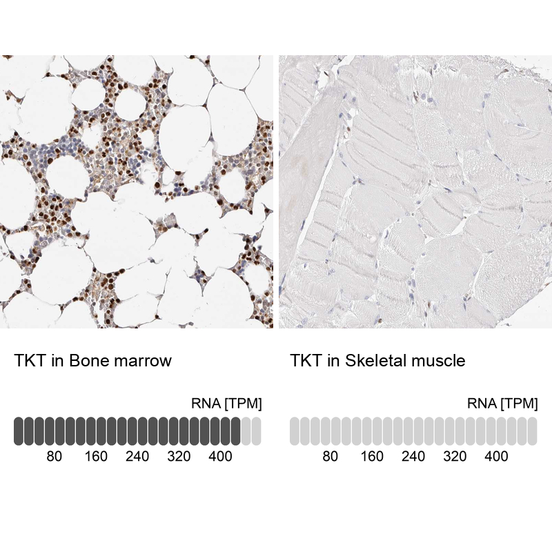 Anti-TKT Antibody