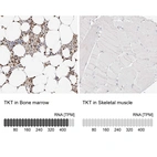 Anti-TKT Antibody