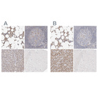 Immunohistochemical staining of human bone marrow, lymph node, pancreas and skeletal muscle using Anti-TKT antibody HPA029480 (A) shows similar protein distribution across tissues to independent antibody HPA029481 (B).