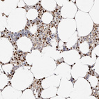 Immunohistochemical staining of human bone marrow shows strong nuclear positivity in hematopoietic cells.