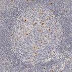 Immunohistochemical staining of human lymph node shows moderate nuclear positivity in a subset of germinal center cells.