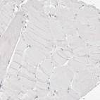 Immunohistochemical staining of human skeletal muscle shows no nuclear positivity in myocytes as expected.