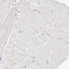 Immunohistochemical staining of human skeletal muscle shows no nuclear positivity in myocytes as expected.