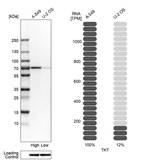 Western blot analysis in human cell lines A-549 and U2OS using Anti-TKT antibody. Corresponding TKT RNA-seq data are presented for the same cell lines. Loading control: Anti-HSP90B1.