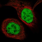 Immunofluorescent staining of human cell line A-431 shows localization to nucleoplasm.