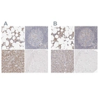 Immunohistochemical staining of human bone marrow, lymph node, pancreas and skeletal muscle using Anti-TKT antibody HPA029481 (A) shows similar protein distribution across tissues to independent antibody HPA029480 (B).