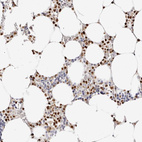 Immunohistochemical staining of human bone marrow shows strong nuclear positivity in hematopoietic cells.