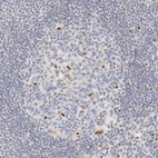 Immunohistochemical staining of human lymph node shows moderate nuclear positivity in subset of germinal center cells.