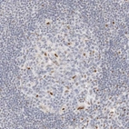 Immunohistochemical staining of human lymph node shows moderate nuclear positivity in subset of germinal center cells.
