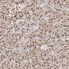 Immunohistochemical staining of human pancreas shows strong nuclear positivity in exocrine glandular cells.