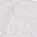 Immunohistochemical staining of human skeletal muscle shows no nuclear positivity in myocytes as expected.