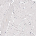 Immunohistochemical staining of human skeletal muscle shows no nuclear positivity in myocytes as expected.