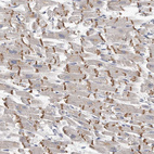 Anti-KLHL7 Antibody