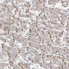 Anti-KLHL7 Antibody