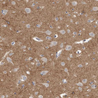 Immunohistochemical staining of human cerebral cortex shows strong positivity in neuropil.