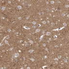 Immunohistochemical staining of human cerebral cortex shows strong positivity in neuropil.