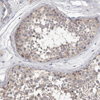 Immunohistochemical staining of human testis shows weak cytoplasmic positivity in cells in seminiferous ducts.