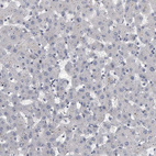 Immunohistochemical staining of human liver shows no positivity in hepatocytes as expected.