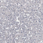 Immunohistochemical staining of human liver shows no positivity in hepatocytes as expected.