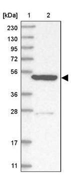 Lane 1: Marker [kDa] 230, 130, 95, 72, 56, 36, 28, 17, 11_br/_Lane 2: Human cell line RT-4