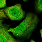 Immunofluorescent staining of human cell line U-2 OS shows localization to nucleoplasm, plasma membrane & cytosol.