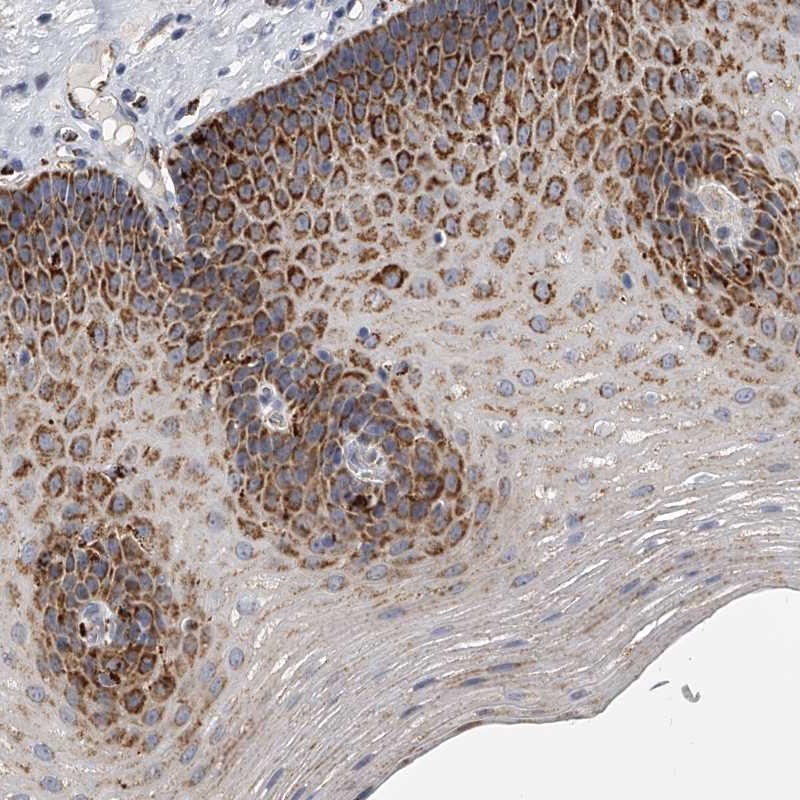 Anti-KLHL7 Antibody
