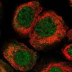 Immunofluorescent staining of human cell line A-431 shows localization to nucleoplasm & cytosol.