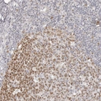 Anti-RFC2 Antibody