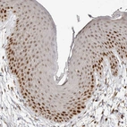 Immunohistochemical staining of human skin shows strong nuclear positivity in squamous epithelial cells.