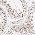 Immunohistochemical staining of human testis shows strong nuclear positivity in cells in seminiferous ducts.