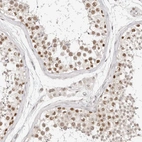 Immunohistochemical staining of human testis shows strong nuclear positivity in cells in seminiferous ducts.