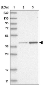 Lane 1: Marker [kDa] 230, 130, 95, 72, 56, 36, 28, 17, 11_br/_Lane 2: Human cell line RT-4_br/_Lane 3: Human cell line U-251MG sp