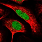 Immunofluorescent staining of human cell line U-2 OS shows localization to nucleoplasm.