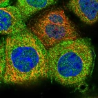 Immunofluorescent staining of human cell line A-431 shows localization to nucleoplasm, plasma membrane & cytosol.
