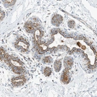 Anti-CAPN13 Antibody
