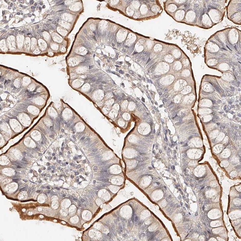 Anti-ZNF789 Antibody