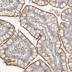 Anti-ZNF789 Antibody