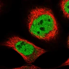 Immunofluorescent staining of human cell line A-431 shows localization to nucleoplasm.
