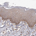 Immunohistochemical staining of human skin shows strong cytoplasmic positivity in squamous epithelial cells.