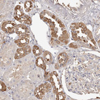 Anti-PKM Antibody